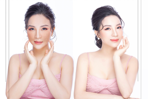 Giải pháp nào cho da nám bị nhiễm Cordicoid